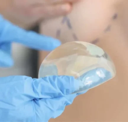 Mellnagyobbítás implantátummal Dr. Fábián Zsolt plasztikai sebésznél