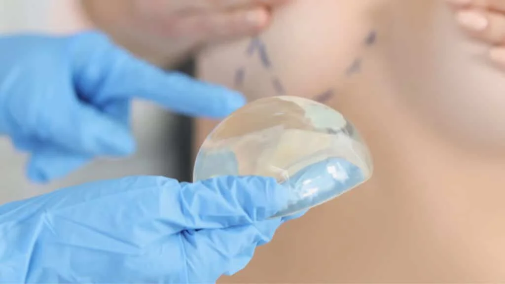 Mellnagyobbítás implantátummal Dr. Fábián Zsolt plasztikai sebésznél