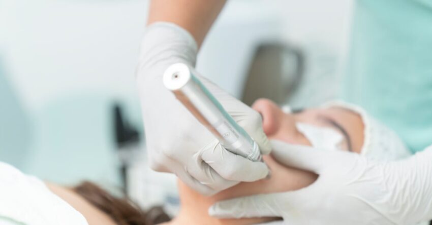 tűs mezoterápiás kezelés Apollon Beauty kozmetika Debrecen